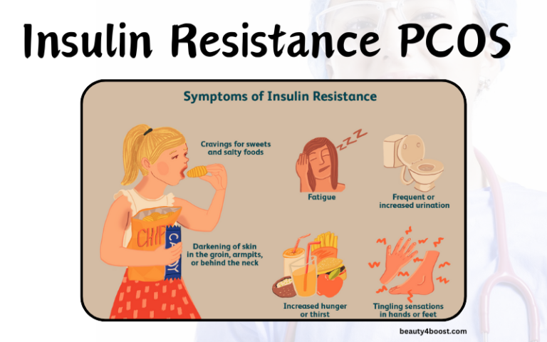 Insulin Resistance PCOS,pcos