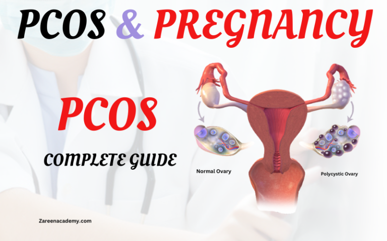 PCOS and Pregnancy,pcos treatment, pcos causes