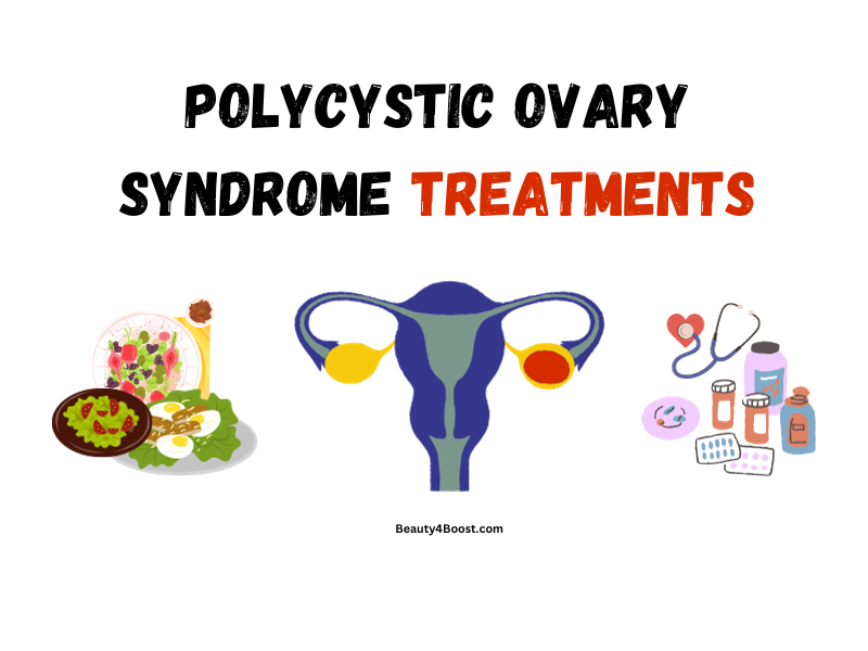 Polycystic Ovary Syndrome Treatments